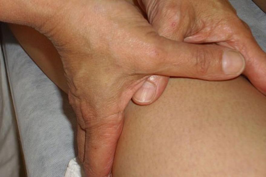Mi lesión: El típico desgarro muscular jugando fútbol